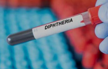 Diphtheria kills ‘over 50’ children in Kano
